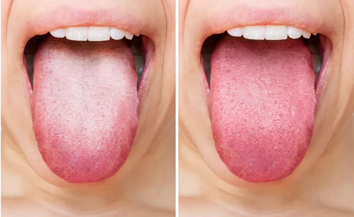 Results & Benefits